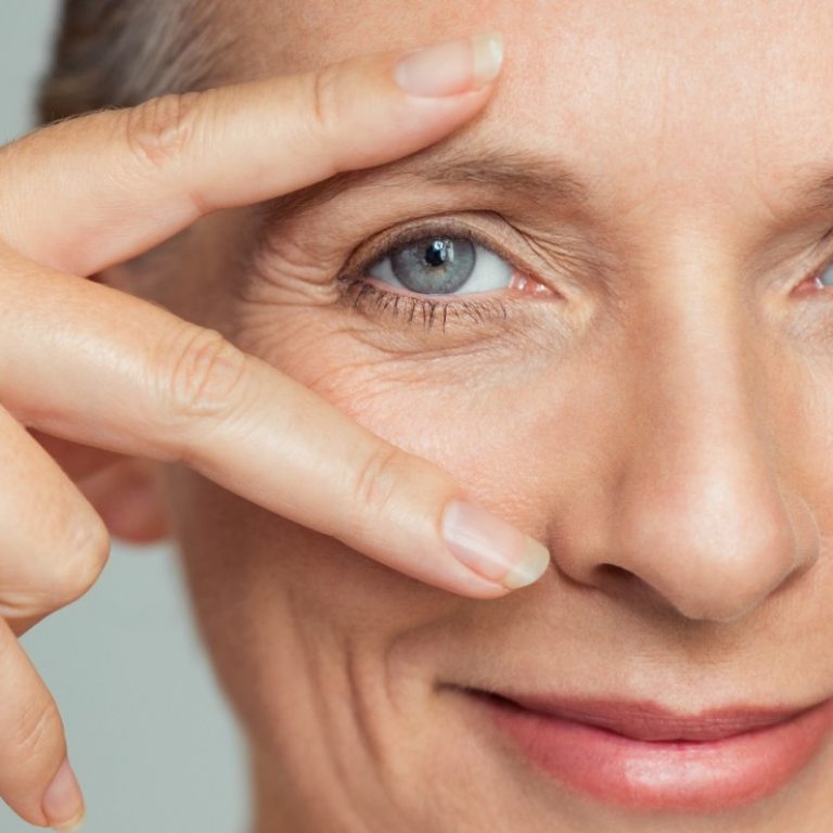 Blefaroplastia en Madrid Lab Vanitas