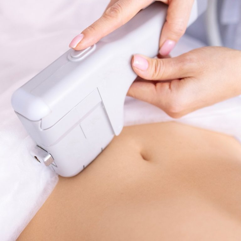 HIFU Corporal en Madrid Lab Vanitas