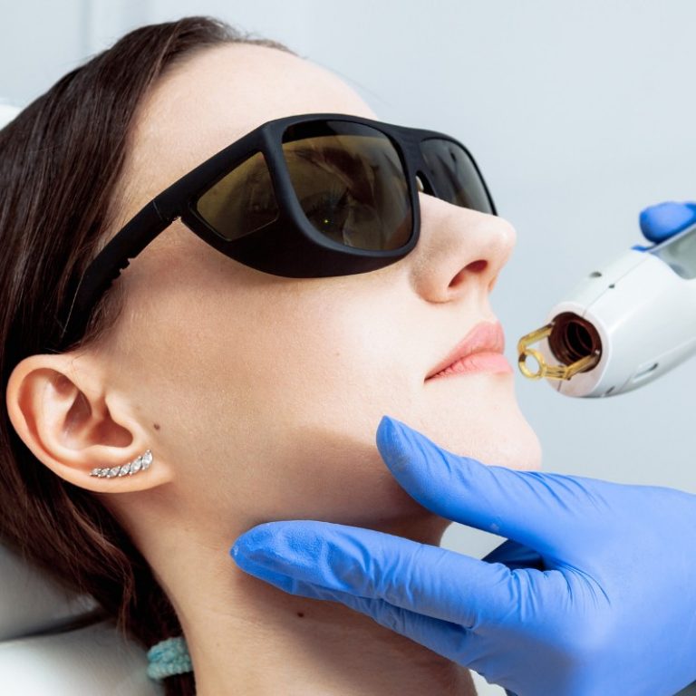 Luz Pulsada Intensa (IPL) en Madrid Lab Vanitas