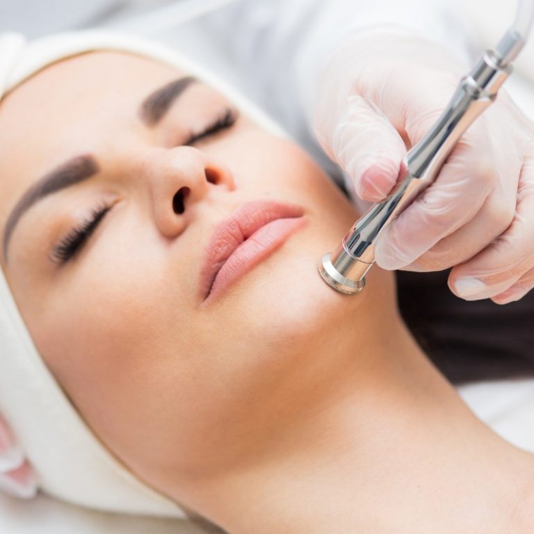 Microdermoabrasión en Madrid Lab Vanitas