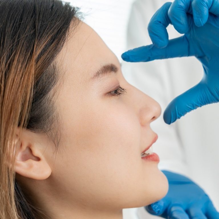 Rinosplastia en Madrid Lab Vanitas